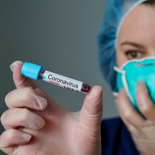 Sobe para 10 o número de casos do COVID-19 em São Miguel do Oeste