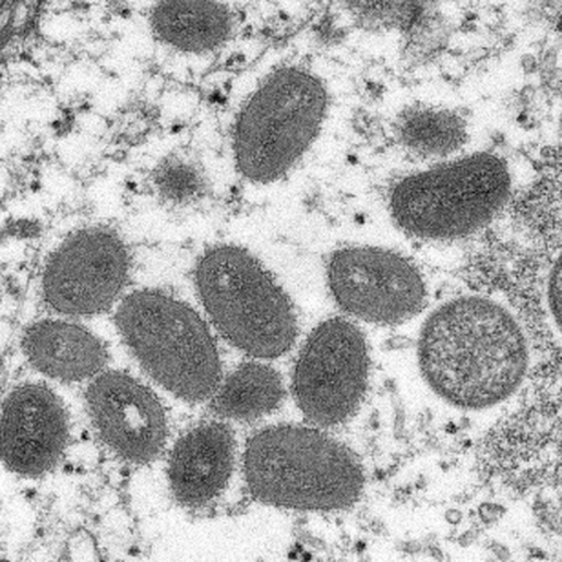 Brasil tem 21 casos confirmados da varíola dos macacos segundo Ministério da Saúde