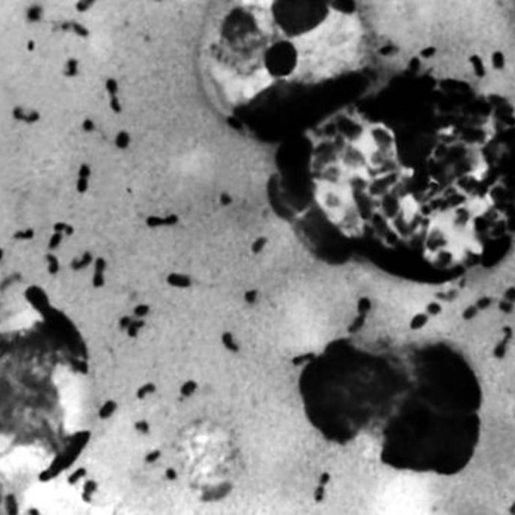 Caso de peste bubônica faz China elevar estado de alerta no norte do país