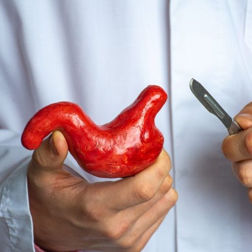 Com novas regras para cirurgia bariátrica, SC tem mais de 400 pessoas na fila do SUS