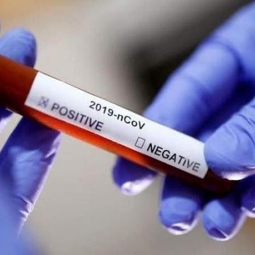 Chapecó se torna a cidade com mais casos em Santa Catarina