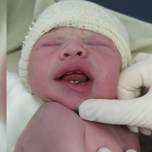 Bebê nasce com dois dentes e surpreende família em Francisco Beltrão