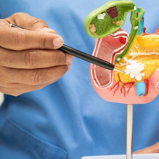 Câncer de pâncreas foi o terceiro mais fatal em mulheres em SC