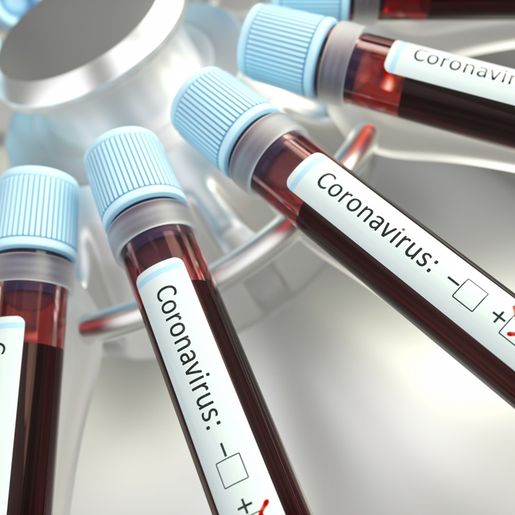 Mulher de 53 anos é o 12ª caso confirmado de COVID-19 em SMO