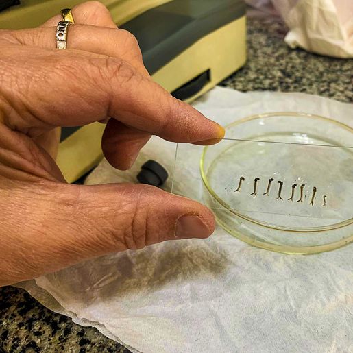 Com 15 casos suspeitos de dengue em 24h, saúde conclama população para combater a doença