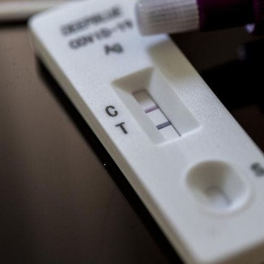 Testes positivos de Covid-19 em farmácias de SC aumentam 124% em novembro