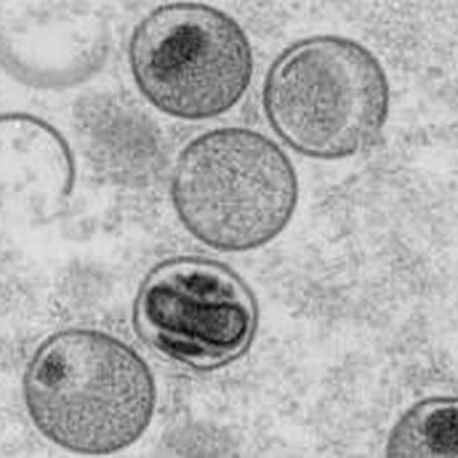 Ministério da Saúde confirma primeira morte por varíola dos macacos no Brasil