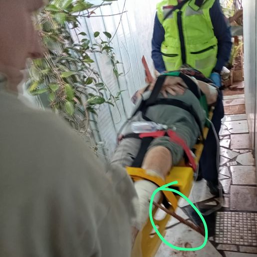 Idosa cai e tem perna perfurada por vergalhão