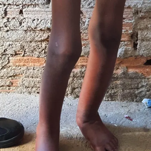 Menino aguarda adoção 2 anos após ser acorrentado a barril