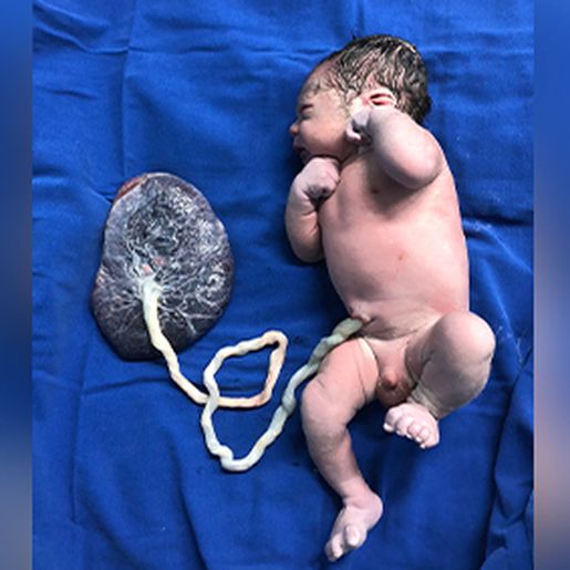 Primeiro bebê nascido em São Miguel do Oeste em 2022 é um menino