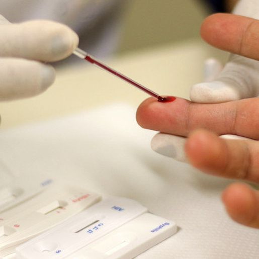 Diagnóstico da Aids cresce em SC, mas número de óbitos apresenta queda