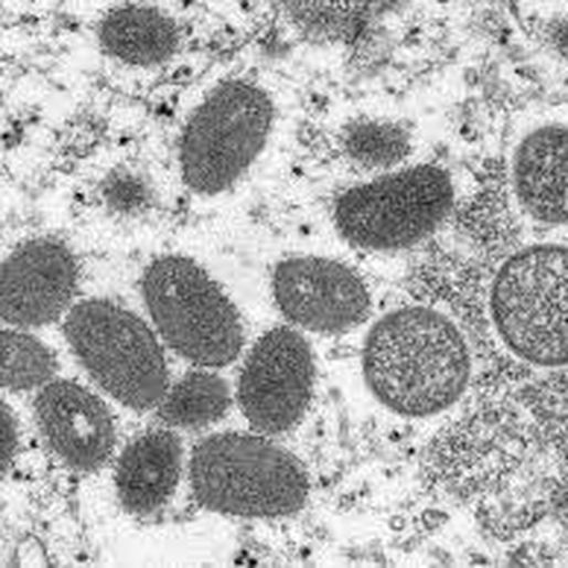 Dive investiga suspeita de caso de varíola dos macacos no Extremo-Oeste