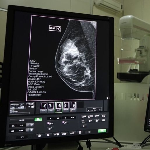 SC realiza mutirão de mamografias com prioridade para pacientes na fila de espera