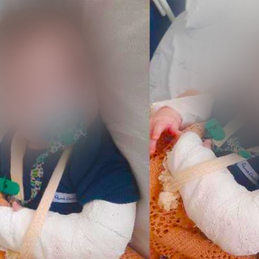 Hospital Regional apura caso de bebê que teve braço quebrado durante internação