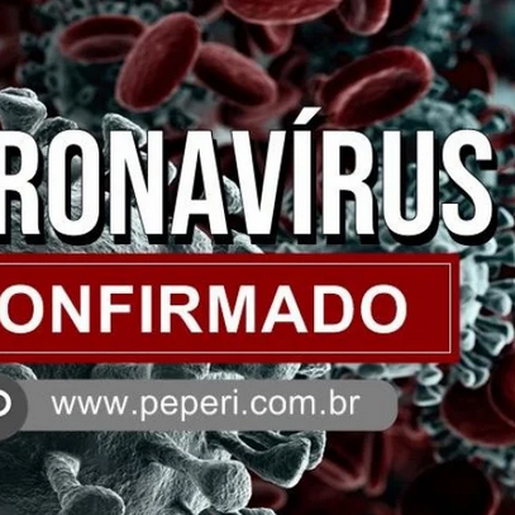Iporã do Oeste confirma seis primeiros casos de Covid-19 em servidores da saúde