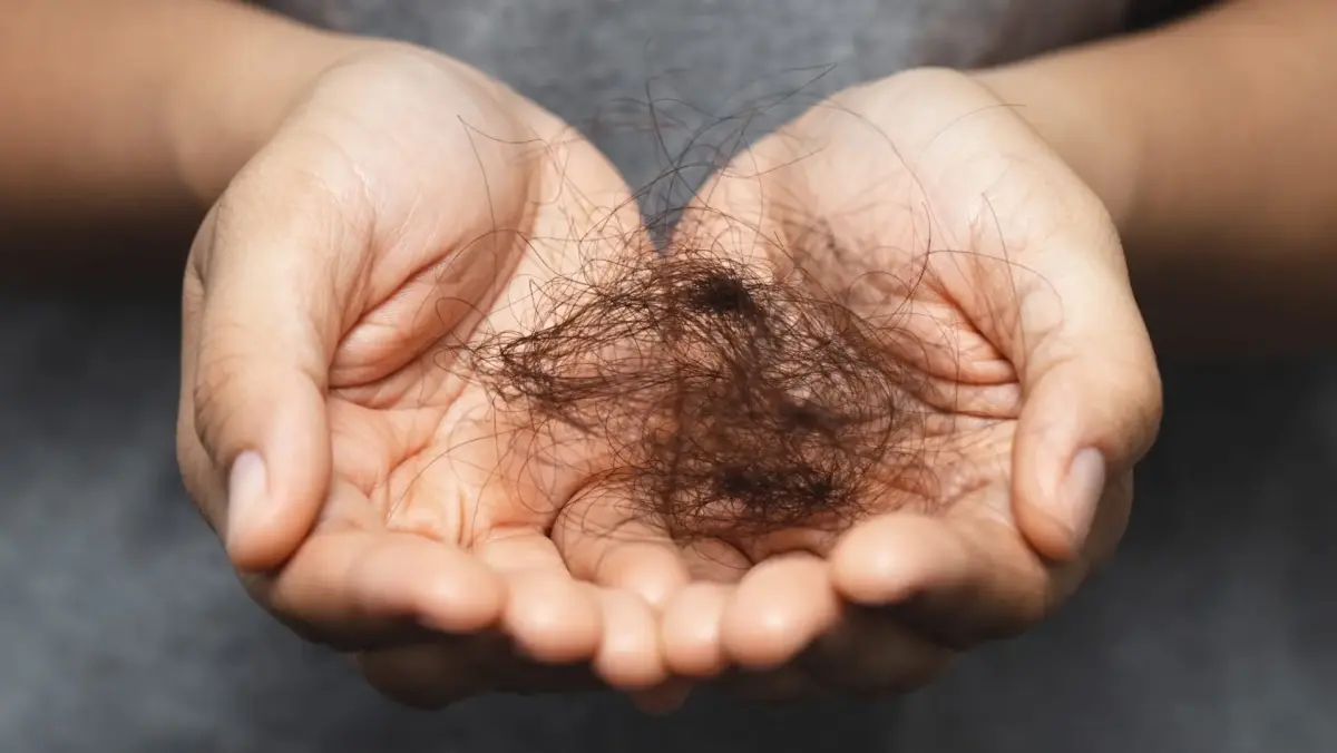 SUS inclui tratamento de câncer sem queda de cabelo que custa R$ 27 mil a sessão no particular