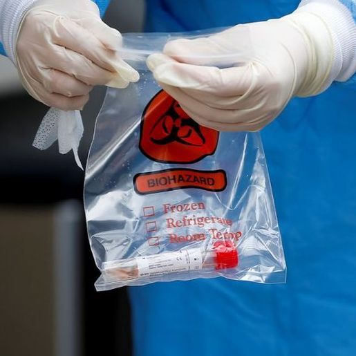 Fiocruz detecta no Paraná novo vírus respiratório com potencial pandêmico