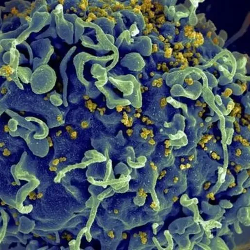 HIV: médicos anunciam 4º caso de cura no mundo