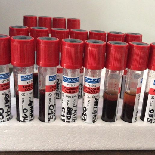 COVID-19: São Miguel do Oeste já testou mais de 650 pessoas