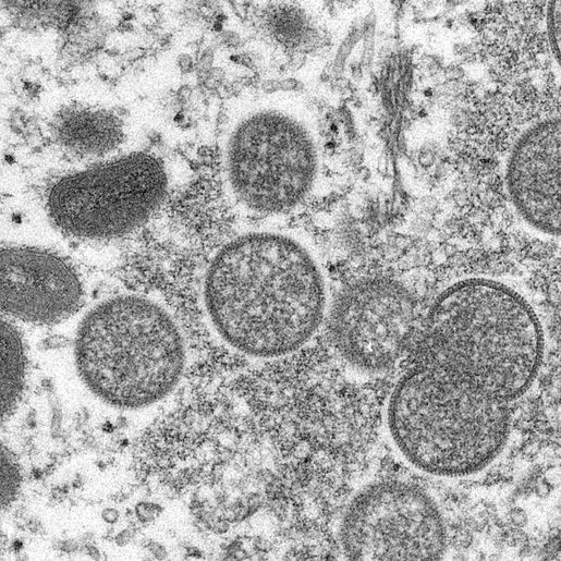 Brasil já registra mais de 200 casos confirmados de varíola dos macacos