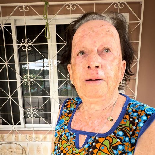 “Parecia o dilúvio que vinha, arrastando tudo” diz moradora sobre caminhão que colidiu em casa