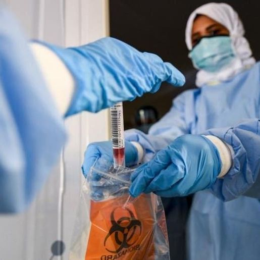 COVID: 15 milhões de doses de vacina podem chegar ao Brasil até o fim do ano