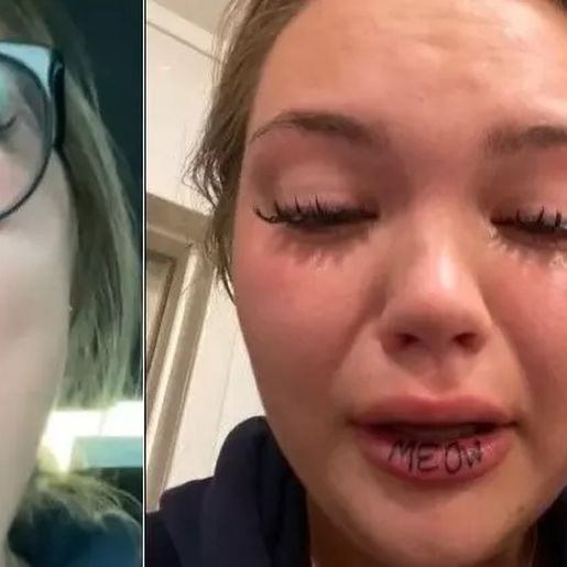 Tatuador erra, e jovem acaba com a palavra ‘miau’ no lábio inferior