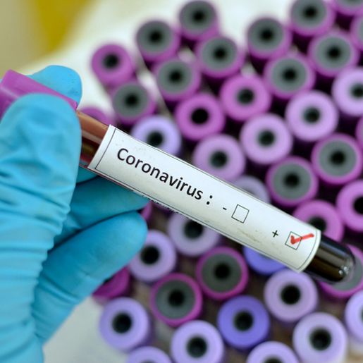 Sobe para 7 o número de casos de Coronavírus em São Miguel do Oeste