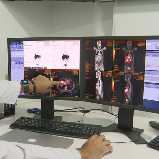 Câncer de próstata tem novo tratamento com radioterapia reduzida