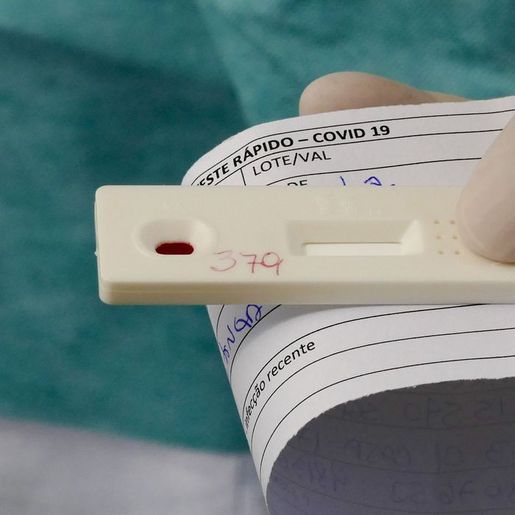 Vital Brazil e UFRJ testam soro para tratar COVID-19