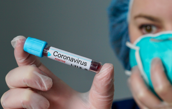 Sobe para 10 o número de casos do COVID-19 em São Miguel do Oeste