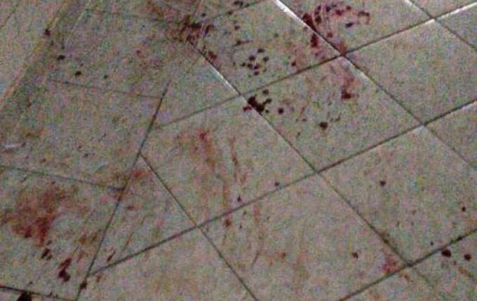 Homens invadem hospital para agredir paciente durante a madrugada