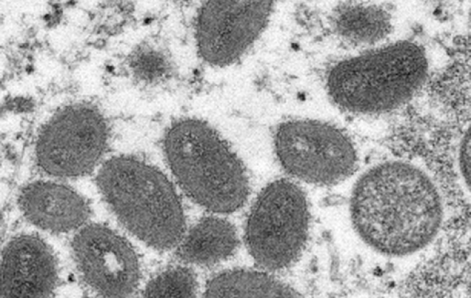 Brasil tem 21 casos confirmados da varíola dos macacos segundo Ministério da Saúde