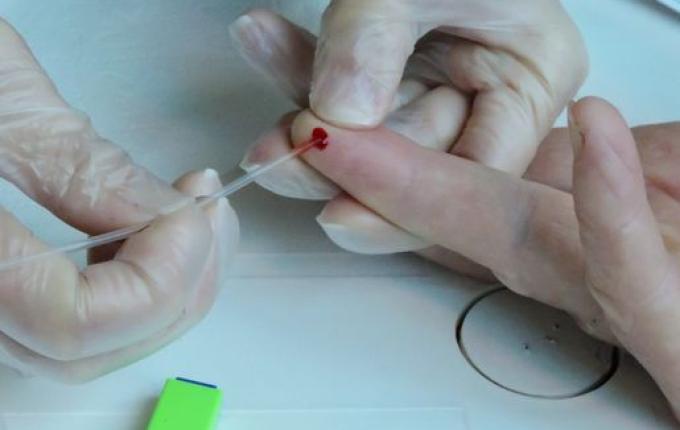 Saúde oportuniza testagem rápida de Hepatite para a população