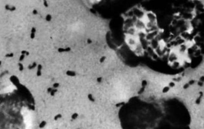 Caso de peste bubônica faz China elevar estado de alerta no norte do país