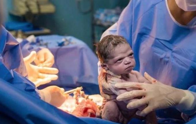 Fotos de bebê que nasceu com cara emburrada fazem sucesso