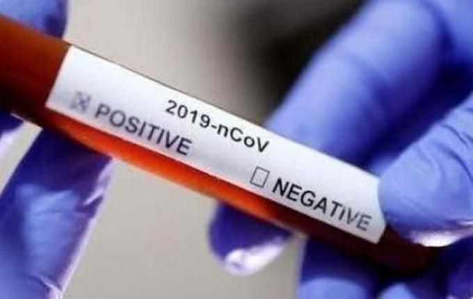 Chapecó se torna a cidade com mais casos em Santa Catarina