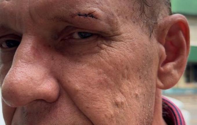 Motorista de SMO vítima de assalto conta detalhes do crime; assista agora