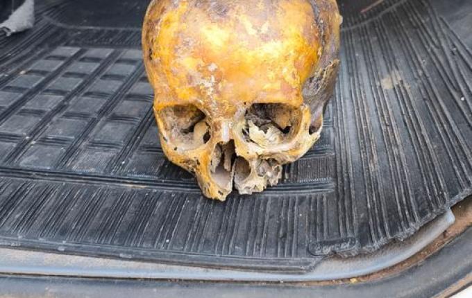 Crânio humano usado como "decoração" é encontrado no lixo