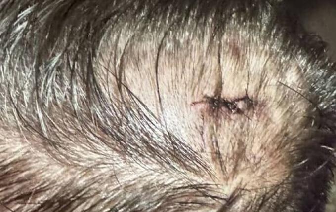 Polícia Civil identifica agressor envolvido em briga na Oktoberfest em menos de 24 horas