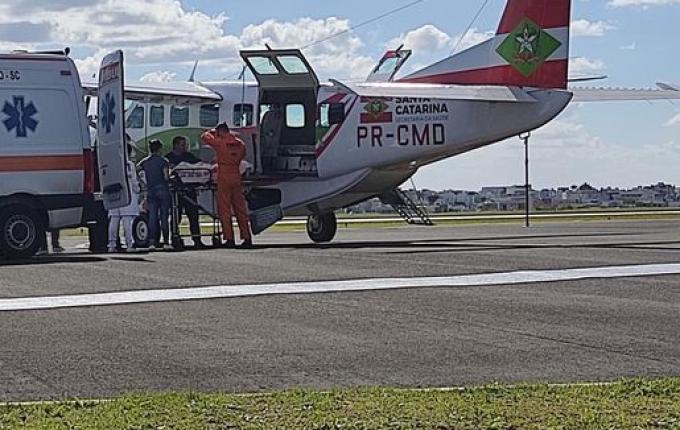 Criança de dois anos com queimaduras de 2° grau é transferida para Florianópolis