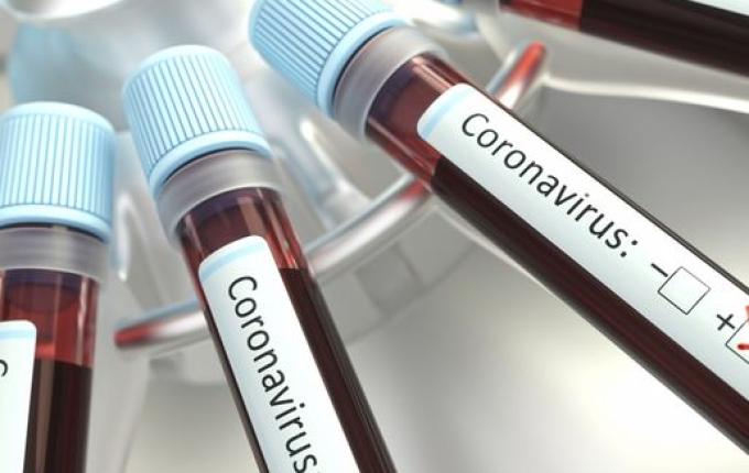 Mulher de 53 anos é o 12ª caso confirmado de COVID-19 em SMO