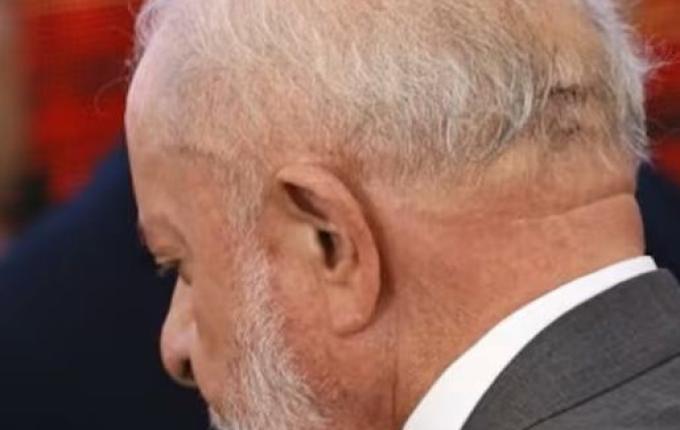 Lula é operado às pressas em São Paulo para drenagem de um hematoma na cabeça