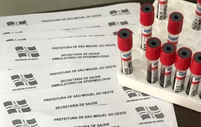 Com mais cinco, número de recuperados em SMO é de 72