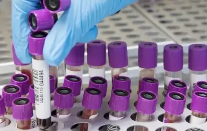 Hepatite misteriosa em crianças deixa governo de SC em alerta