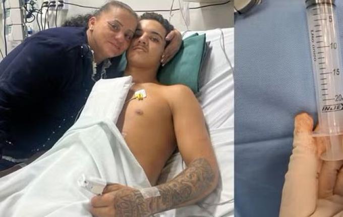 Sem querer, jovem dispara pistola de pregos no próprio coração em SC