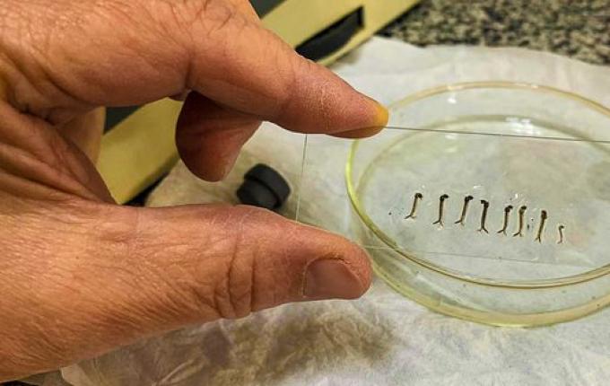 Com 15 casos suspeitos de dengue em 24h, saúde conclama população para combater a doença