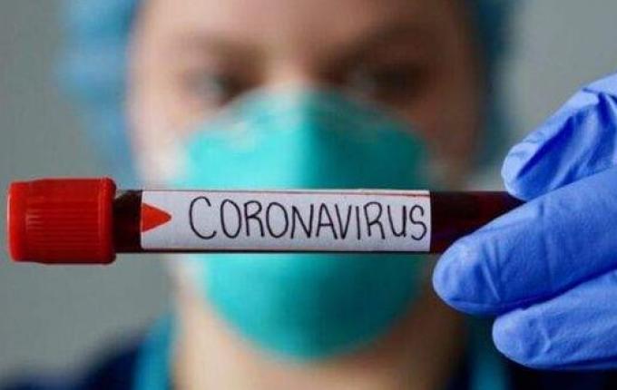 SMO: Somente pacientes graves coletarão exames para Coronavírus