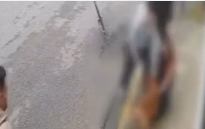 'Não me soltou mais', diz jovem atacada e ferida por pitbull a caminho do trabalho em SC