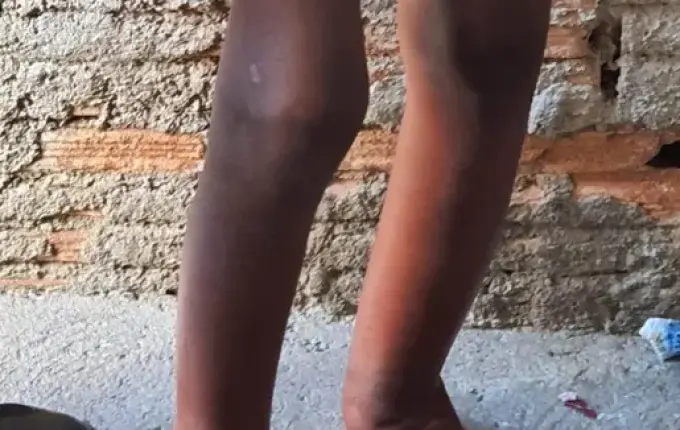 Menino aguarda adoção 2 anos após ser acorrentado a barril